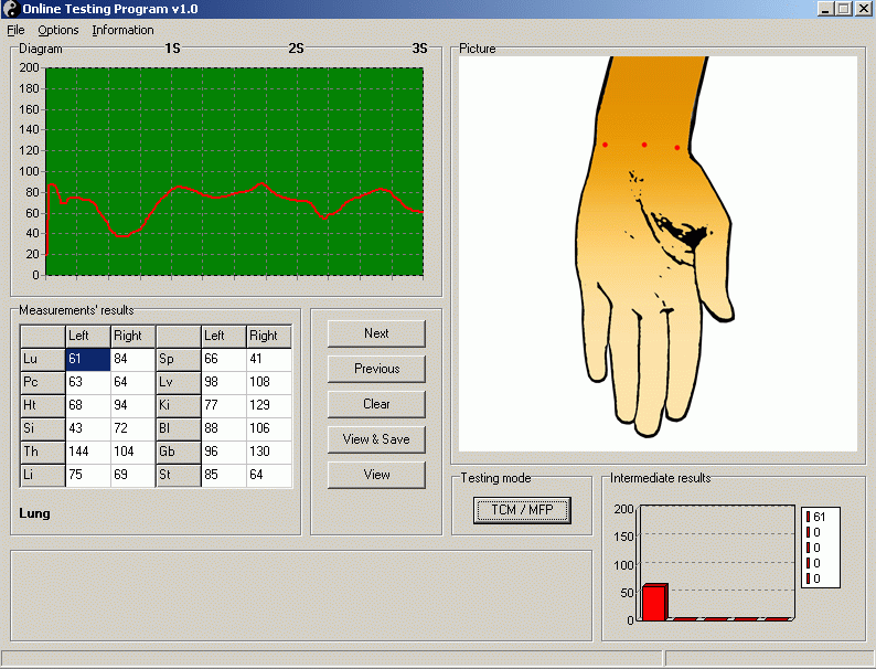 Ryodoraku Online Testing Program v1.0 Screenshot